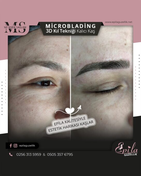 Nazilli - Microblading 3D Kıl Tekniği Kalıcı Kaş Kontürü