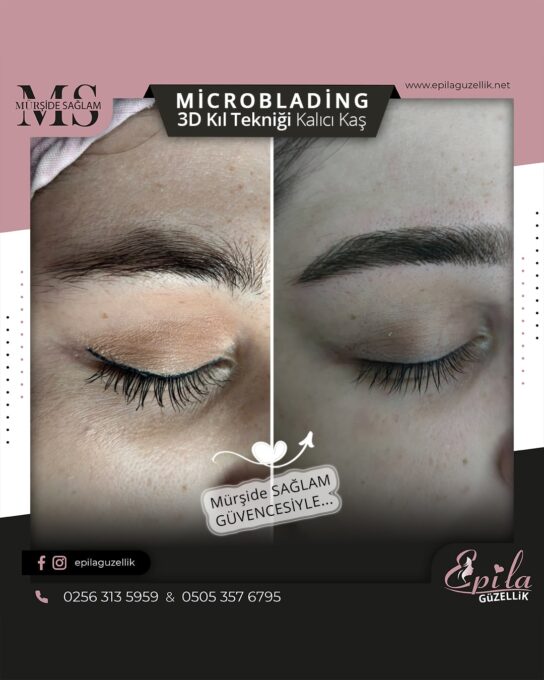 Nazilli - Microblading 3D Kıl Tekniği Kalıcı Kaş Kontürü