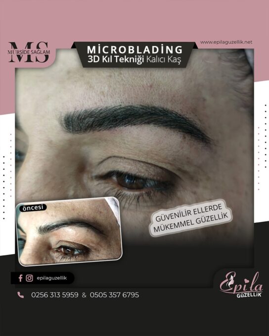 Nazilli - Microblading 3D Kıl Tekniği Kalıcı Kaş Kontürü