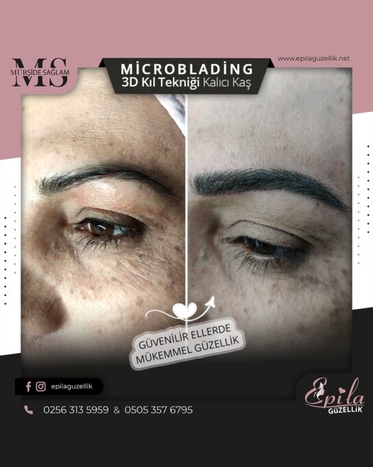 Nazilli - Microblading 3D Kıl Tekniği Kalıcı Kaş Kontürü