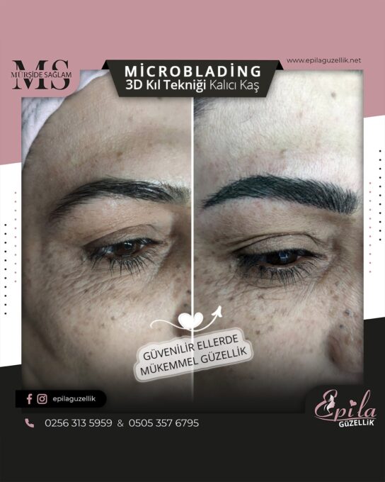 Nazilli - Microblading 3D Kıl Tekniği Kalıcı Kaş Kontürü