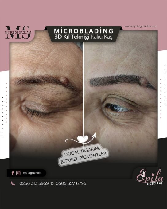 Nazilli - Microblading 3D Kıl Tekniği Kalıcı Kaş Kontürü