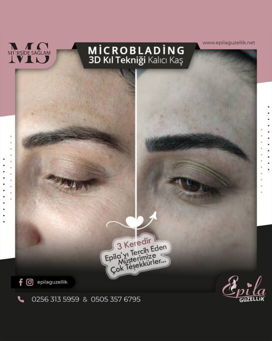 Nazilli - Microblading 3D Kıl Tekniği Kalıcı Kaş Kontürü