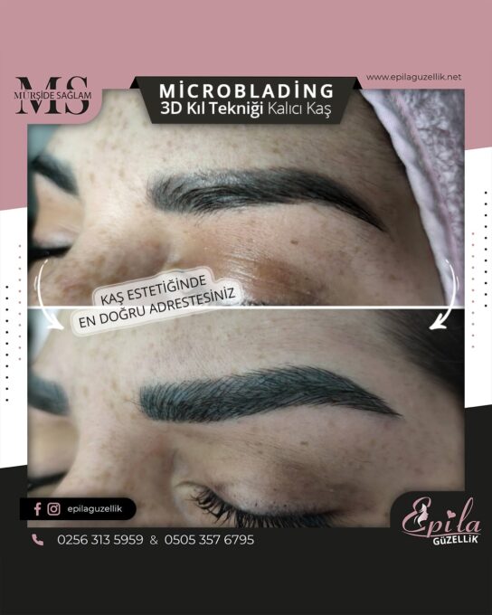 Nazilli - Microblading 3D Kıl Tekniği Kalıcı Kaş Kontürü