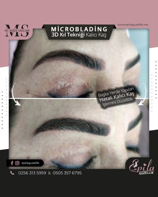 Nazilli - Microblading 3D Kıl Tekniği Kalıcı Kaş Kontürü