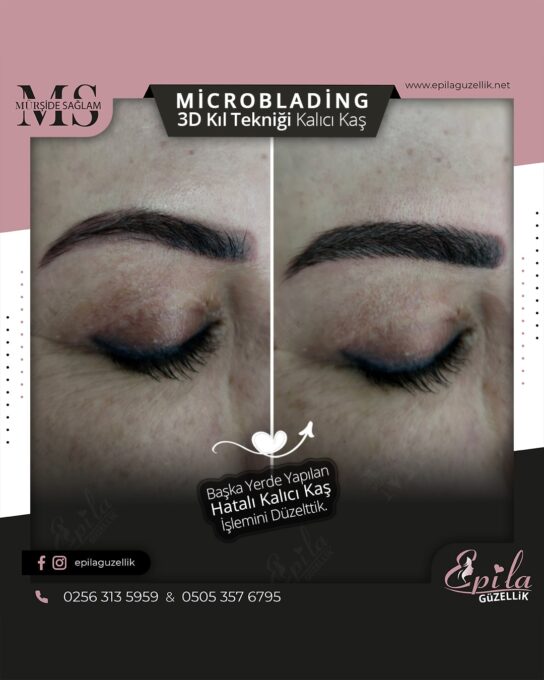 Nazilli - Microblading 3D Kıl Tekniği Kalıcı Kaş Kontürü