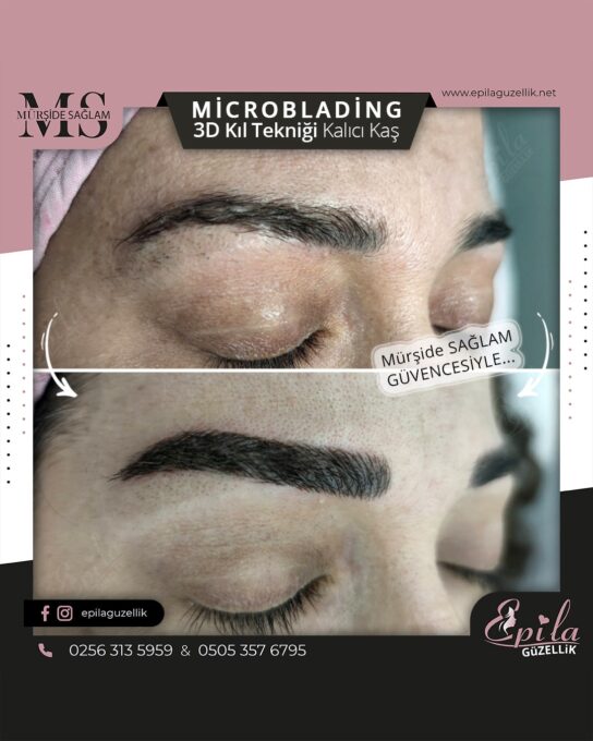 Nazilli - Microblading 3D Kıl Tekniği Kalıcı Kaş Kontürü