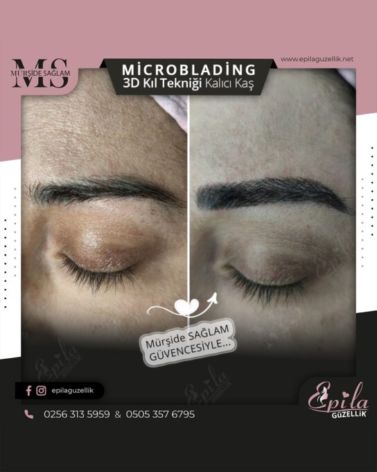 Nazilli - Microblading 3D Kıl Tekniği Kalıcı Kaş Kontürü