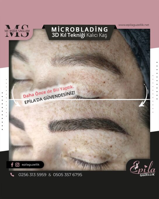 Nazilli - Microblading 3D Kıl Tekniği Kalıcı Kaş Kontürü