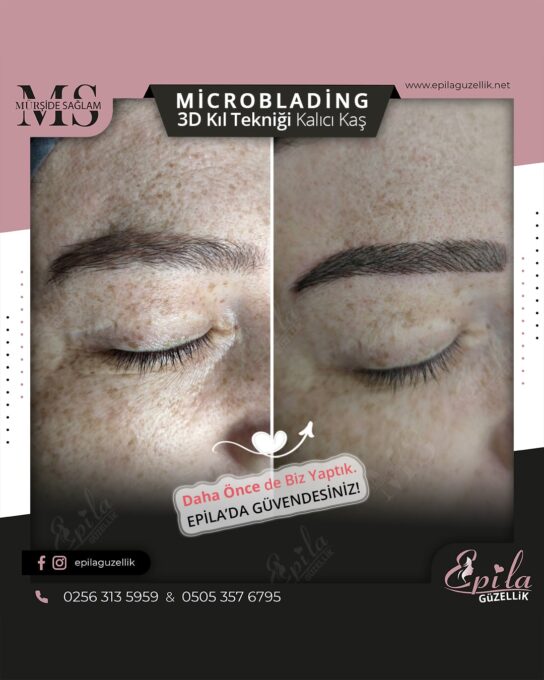 Nazilli - Microblading 3D Kıl Tekniği Kalıcı Kaş Kontürü