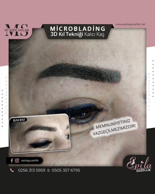 Nazilli - Microblading 3D Kıl Tekniği Kalıcı Kaş Kontürü