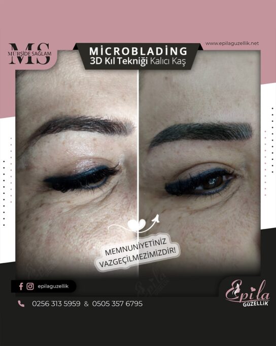 Nazilli - Microblading 3D Kıl Tekniği Kalıcı Kaş Kontürü