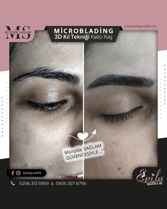 Nazilli - Microblading 3D Kıl Tekniği Kalıcı Kaş Kontürü