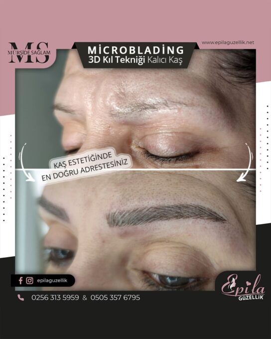 Nazilli - Microblading 3D Kıl Tekniği Kalıcı Kaş Kontürü