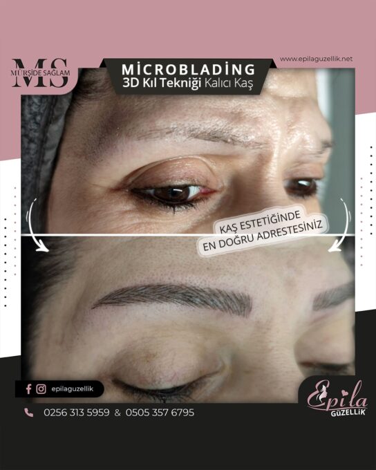 Nazilli - Microblading 3D Kıl Tekniği Kalıcı Kaş Kontürü