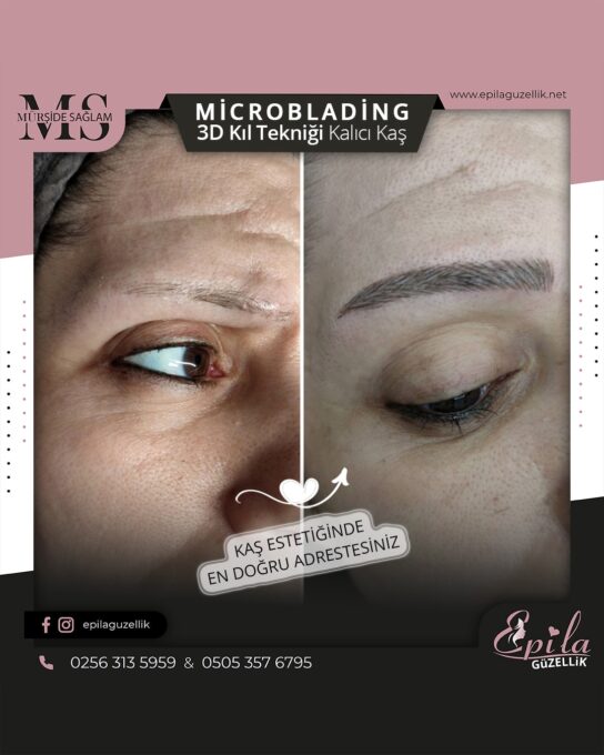 Nazilli - Microblading 3D Kıl Tekniği Kalıcı Kaş Kontürü