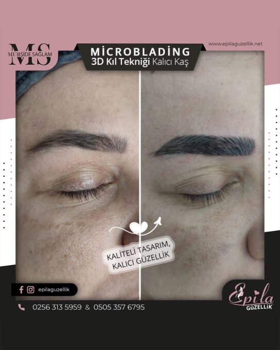 Nazilli - Microblading 3D Kıl Tekniği Kalıcı Kaş Kontürü