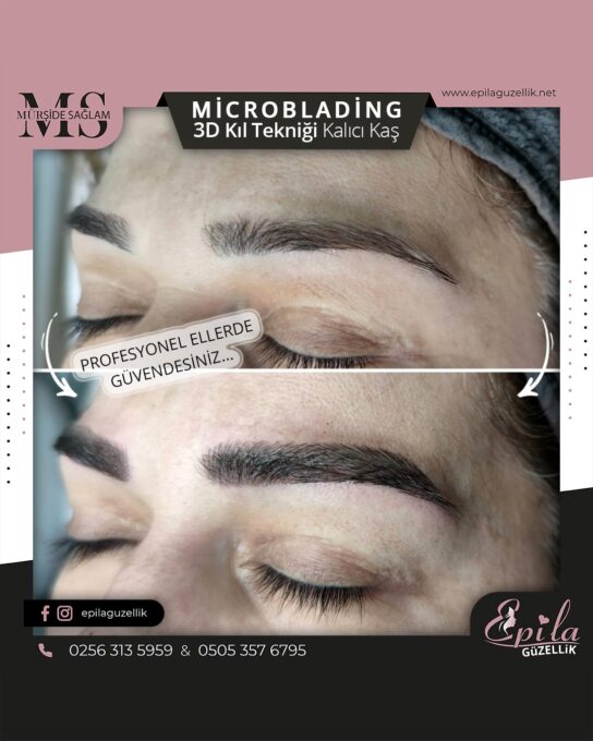 Nazilli - Microblading 3D Kıl Tekniği Kalıcı Kaş Kontürü