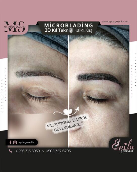 Nazilli - Microblading 3D Kıl Tekniği Kalıcı Kaş Kontürü