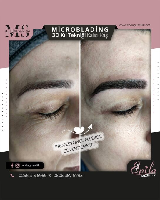 Nazilli - Microblading 3D Kıl Tekniği Kalıcı Kaş Kontürü