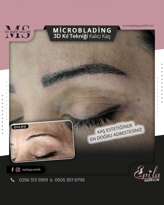 Nazilli - Microblading 3D Kıl Tekniği Kalıcı Kaş Kontürü