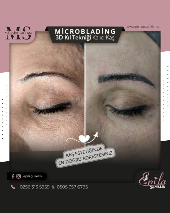 Nazilli - Microblading 3D Kıl Tekniği Kalıcı Kaş Kontürü