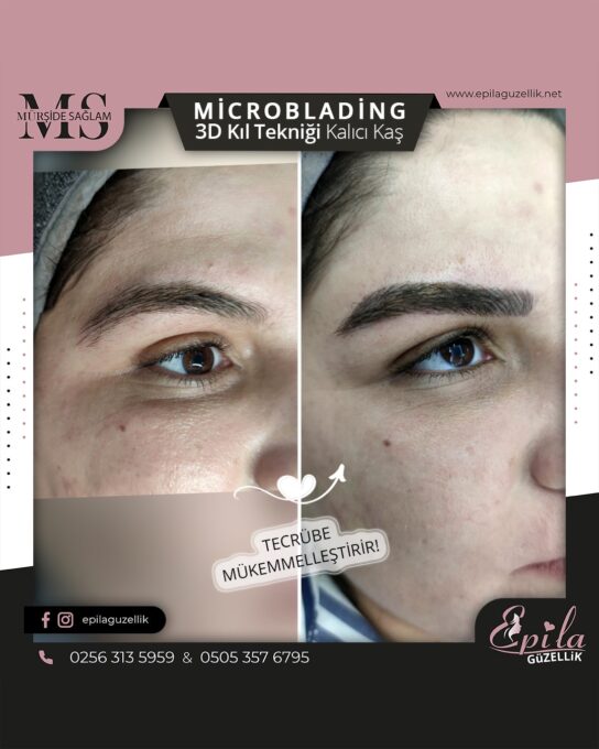 Nazilli - Microblading 3D Kıl Tekniği Kalıcı Kaş Kontürü