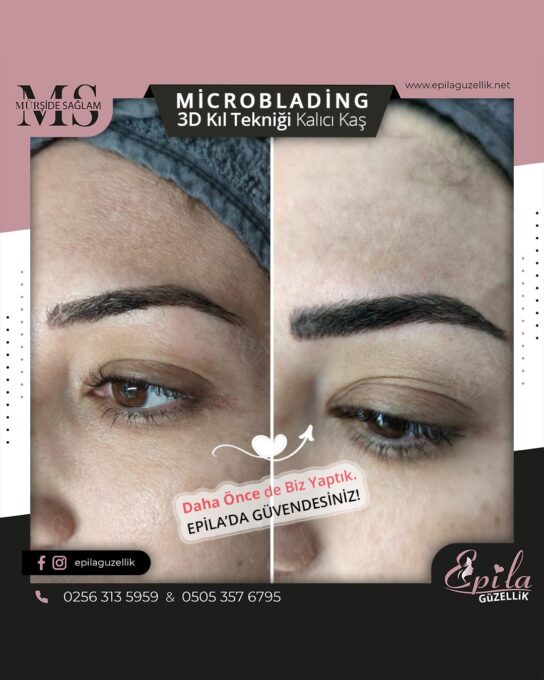 Nazilli - Microblading 3D Kıl Tekniği Kalıcı Kaş Kontürü