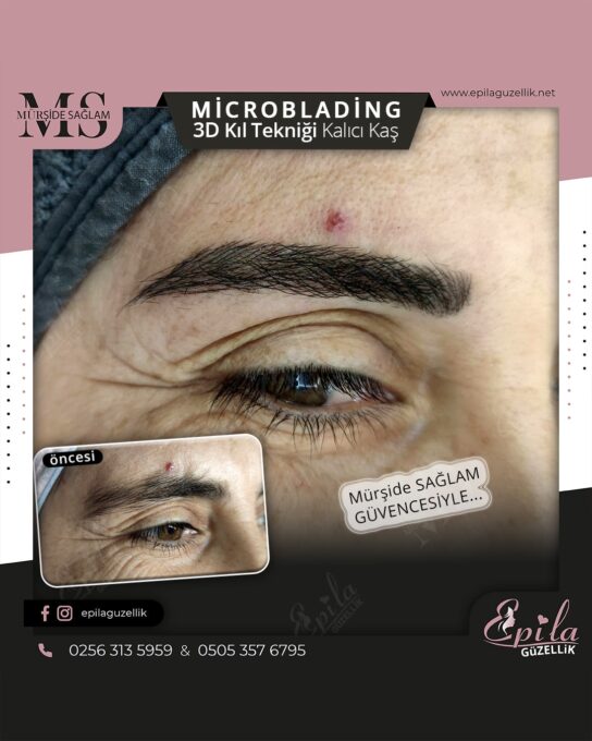 Nazilli - Microblading 3D Kıl Tekniği Kalıcı Kaş Kontürü