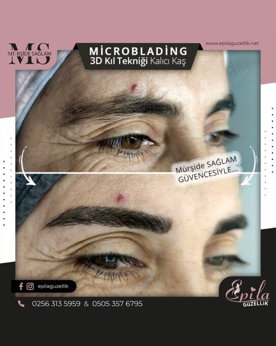 Nazilli - Microblading 3D Kıl Tekniği Kalıcı Kaş Kontürü