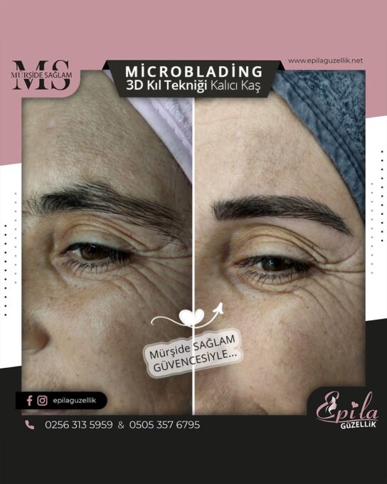 Nazilli - Microblading 3D Kıl Tekniği Kalıcı Kaş Kontürü