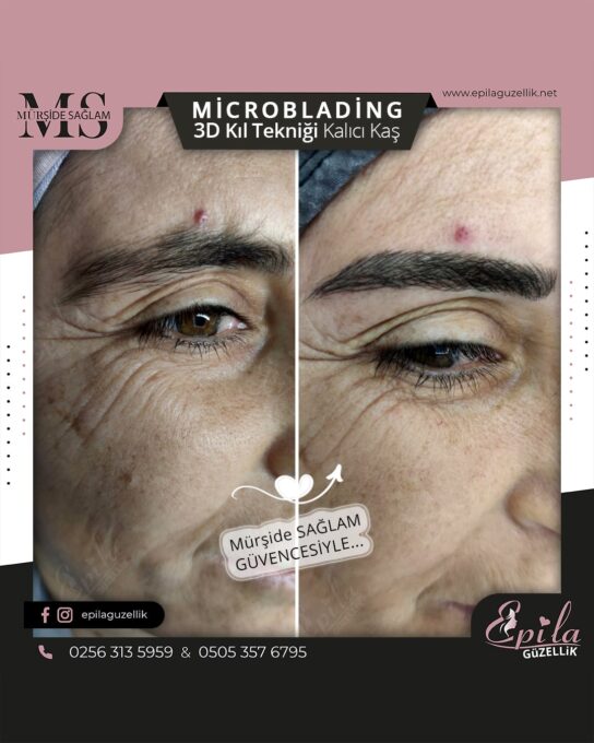 Nazilli - Microblading 3D Kıl Tekniği Kalıcı Kaş Kontürü