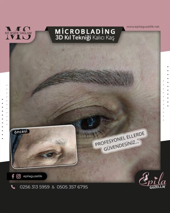 Nazilli - Microblading 3D Kıl Tekniği Kalıcı Kaş Kontürü