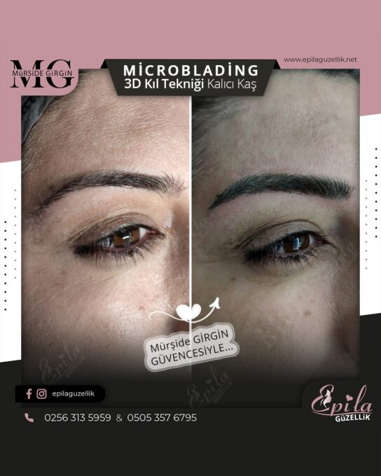 Nazilli - Microblading 3D Kıl Tekniği Kalıcı Kaş Kontürü