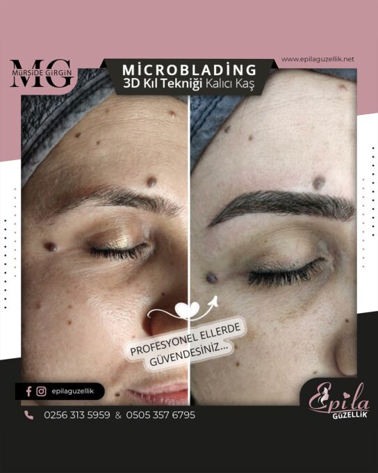 Nazilli - Microblading 3D Kıl Tekniği Kalıcı Kaş Kontürü