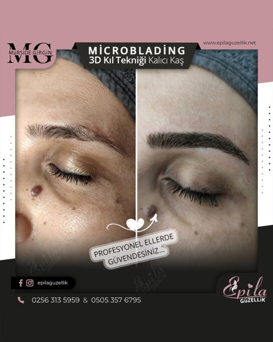 Nazilli - Microblading 3D Kıl Tekniği Kalıcı Kaş Kontürü