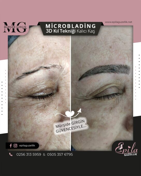 Nazilli - Microblading 3D Kıl Tekniği Kalıcı Kaş Kontürü