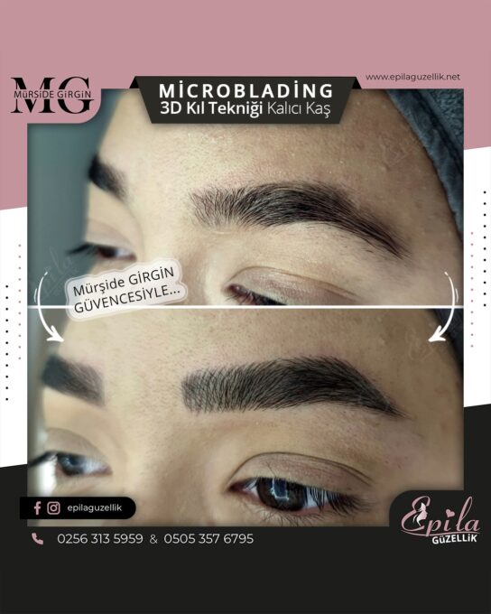 Nazilli - Microblading 3D Kıl Tekniği Kalıcı Kaş Kontürü