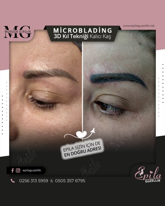 Nazilli - Microblading 3D Kıl Tekniği Kalıcı Kaş Kontürü