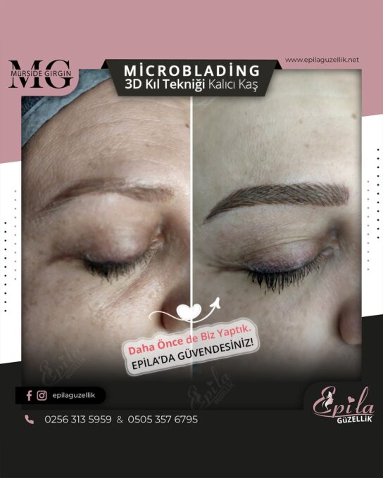 Nazilli - Microblading 3D Kıl Tekniği Kalıcı Kaş Kontürü