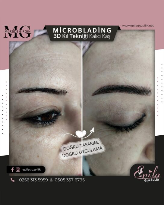 Nazilli - Microblading 3D Kıl Tekniği Kalıcı Kaş Kontürü