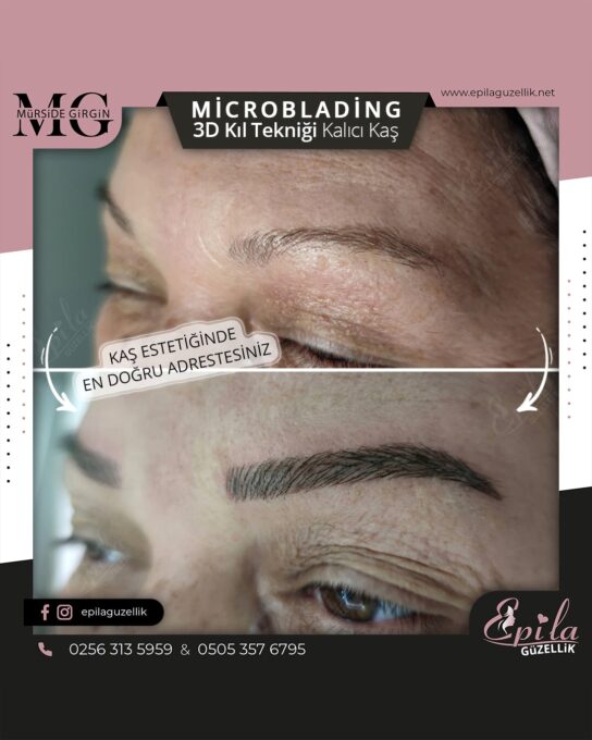 Nazilli - Microblading 3D Kıl Tekniği Kalıcı Kaş Kontürü