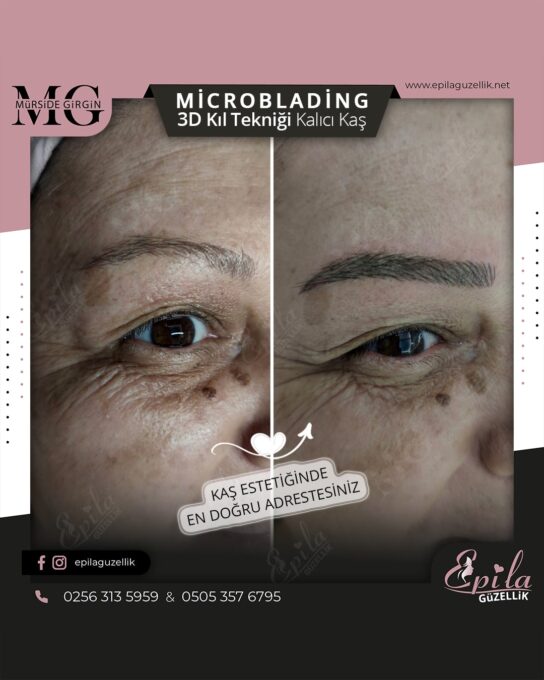 Nazilli - Microblading 3D Kıl Tekniği Kalıcı Kaş Kontürü