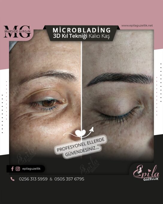 Nazilli - Microblading 3D Kıl Tekniği Kalıcı Kaş Kontürü