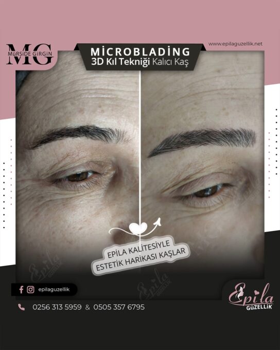 Nazilli - Microblading 3D Kıl Tekniği Kalıcı Kaş Kontürü