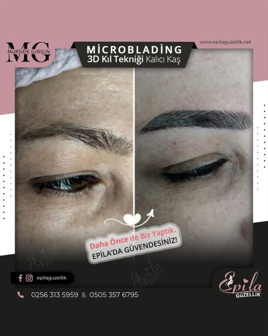 Nazilli - Microblading 3D Kıl Tekniği Kalıcı Kaş Kontürü