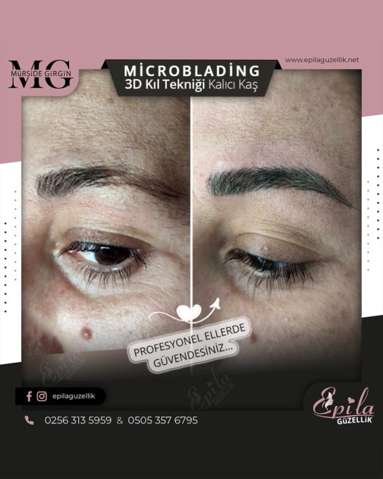 Nazilli - Microblading 3D Kıl Tekniği Kalıcı Kaş Kontürü