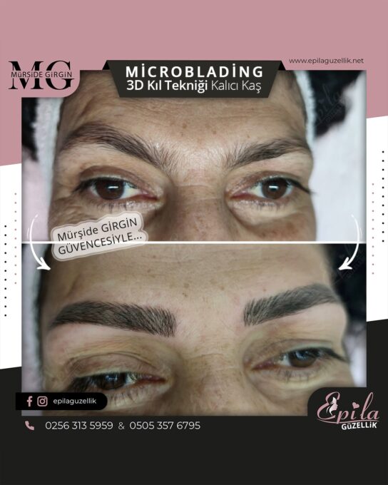 Nazilli - Microblading 3D Kıl Tekniği Kalıcı Kaş Kontürü