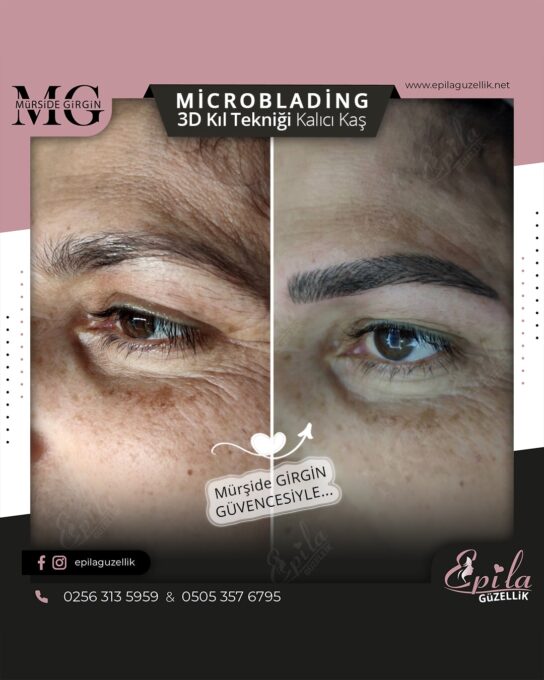 Nazilli - Microblading 3D Kıl Tekniği Kalıcı Kaş Kontürü