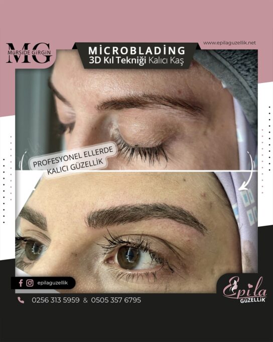 Nazilli - Microblading 3D Kıl Tekniği Kalıcı Kaş Kontürü